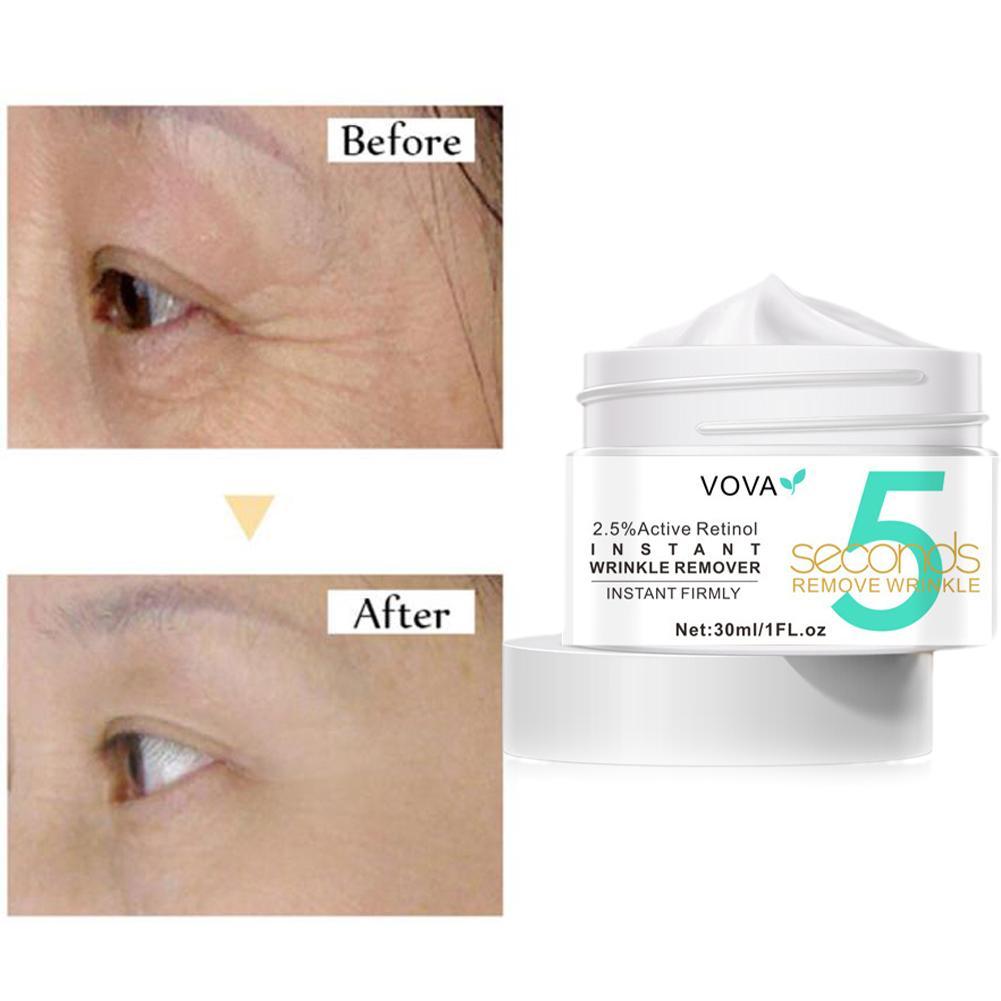 2.5% Active Retinol Eye Cream  - Retinol Anti Wrinkle Cream review and price