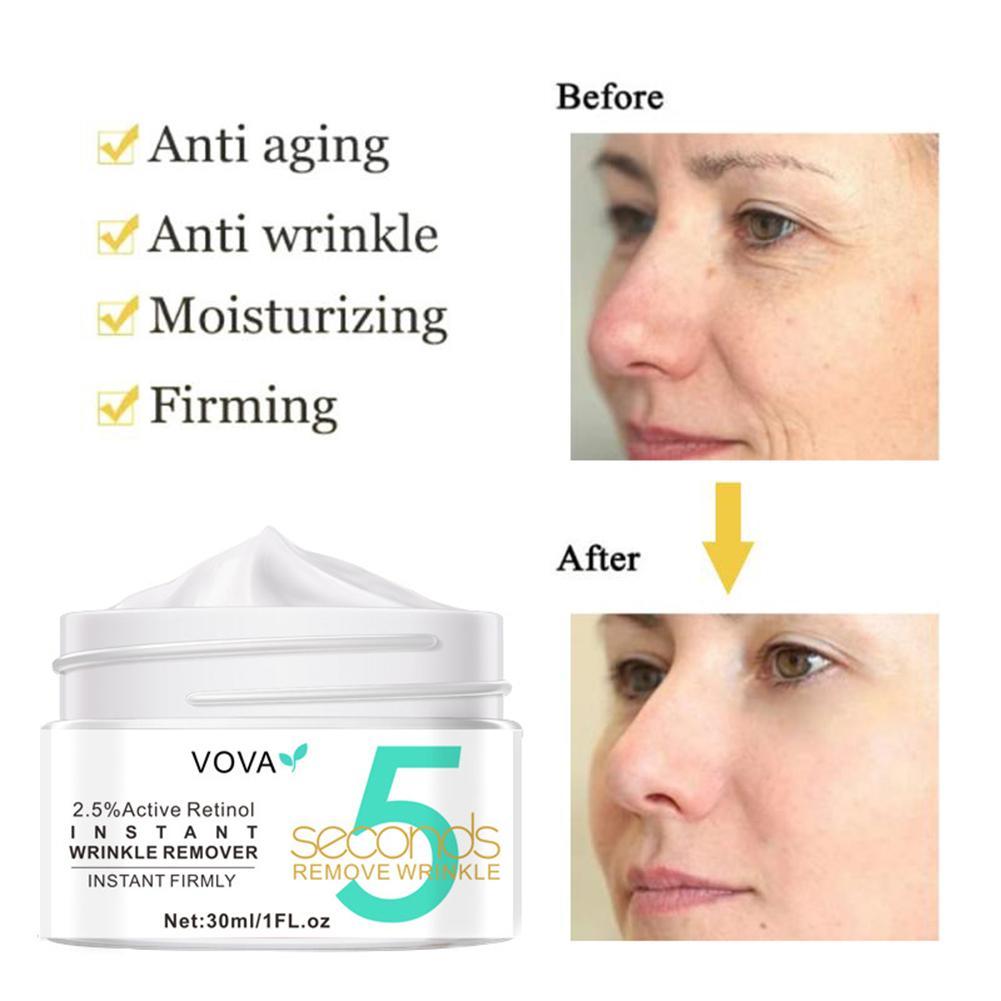 2.5% Active Retinol Eye Cream  - Retinol Anti Wrinkle Cream review and price