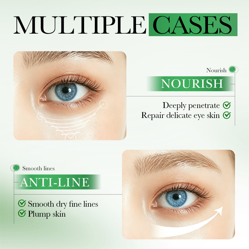 60pcs SADOER Centella Asiatica - Collagen Under Eye Patches review and price