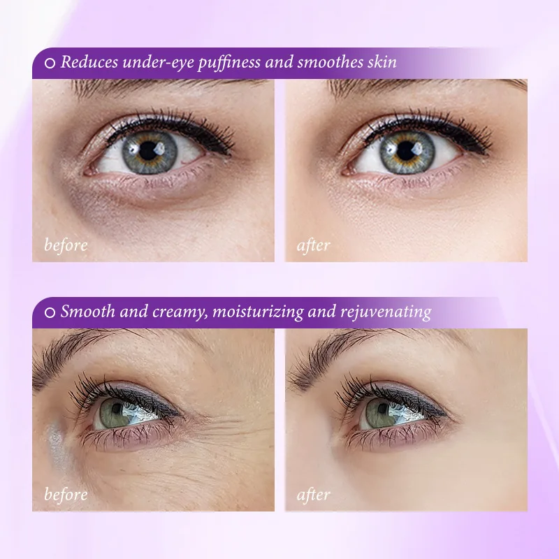 Instant Eye Bag Removal Cream  - Retinol Anti Wrinkle Cream review and price
